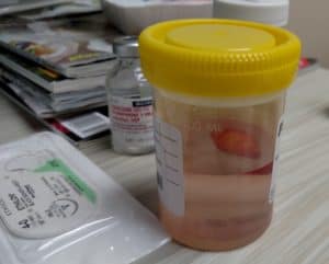 lab sample