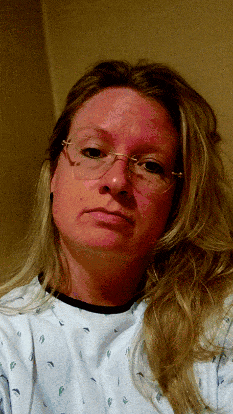 Facing the fear of melanoma and overcoming it is not easy, but it is important that you don't let the fear of melanoma keep you from getting checked out. | TheMountainKitchen.com